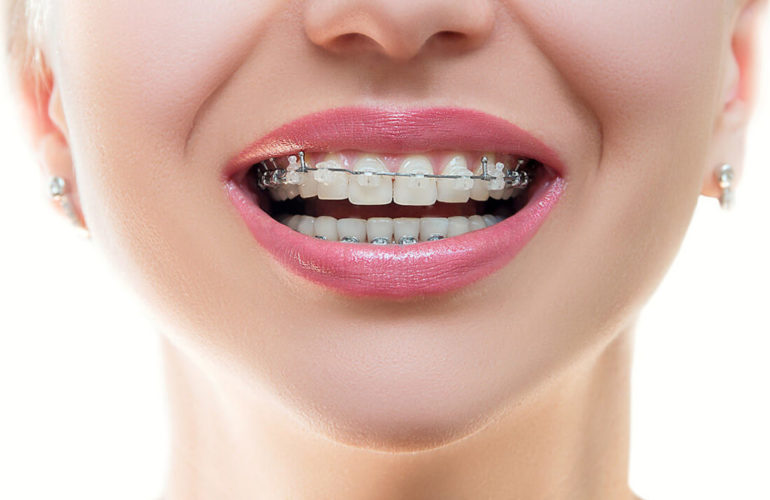 Ortodoncija Bjelovar