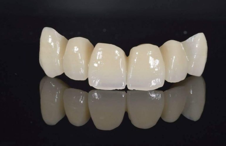 Krunice za zube Bjelovar