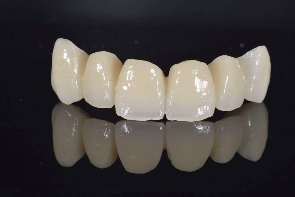 Krunice za zube Bjelovar