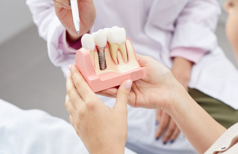 Zubni implantati stomatolog bjelovar