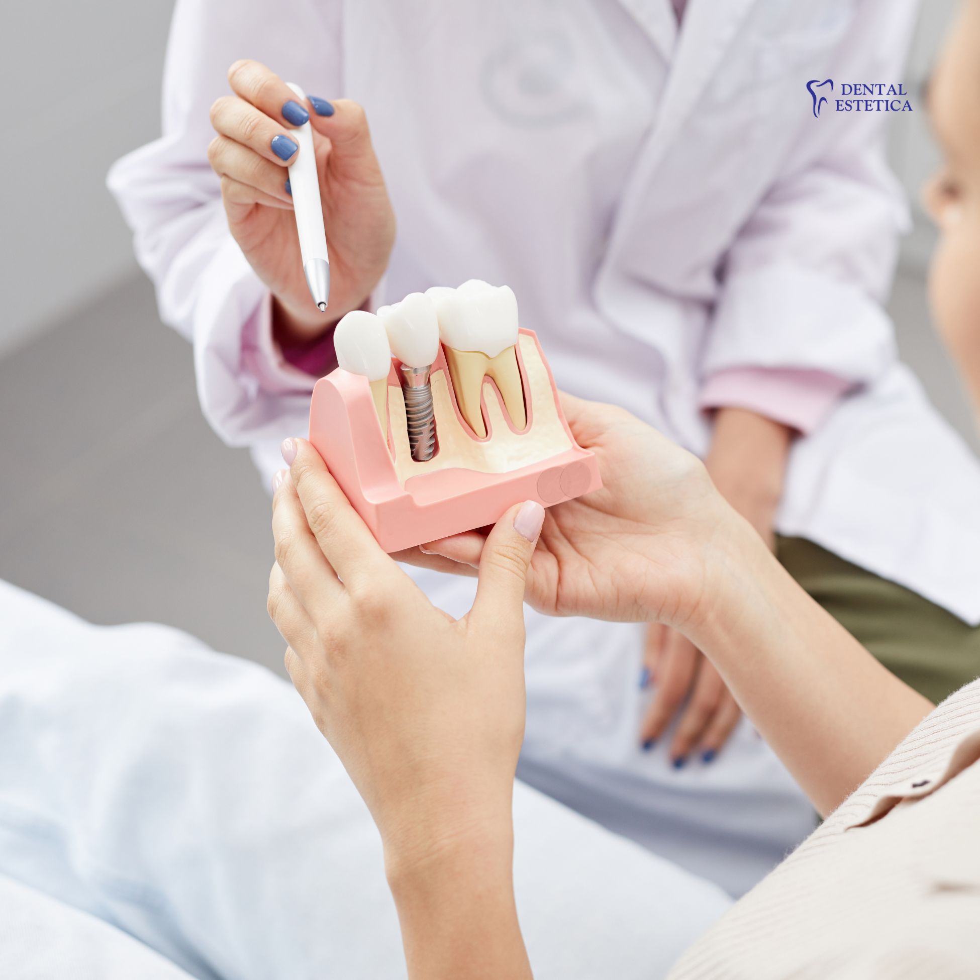 Zubni implantati stomatolog bjelovar